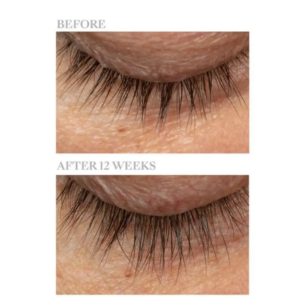 Lash + Brow Serum - White